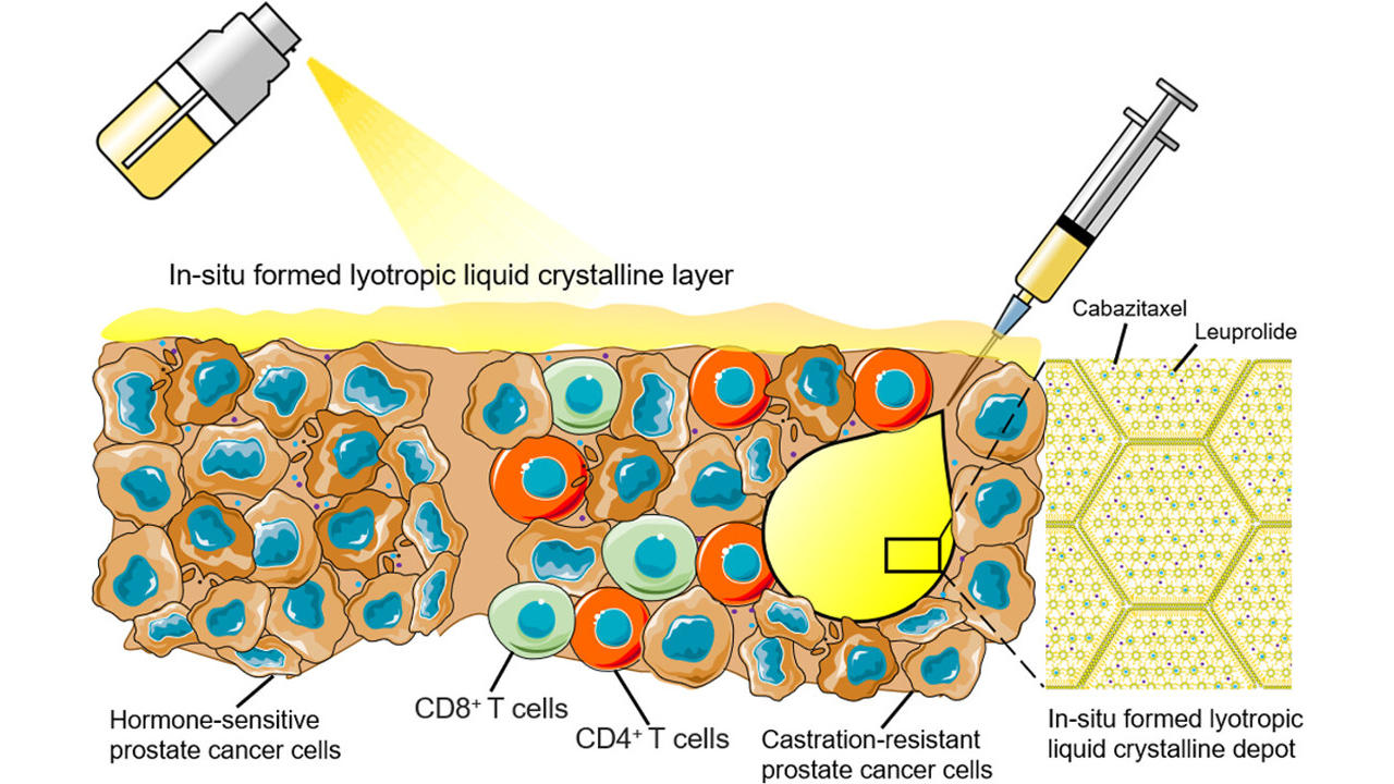 What is Castration Sensitive Prostate Cancer