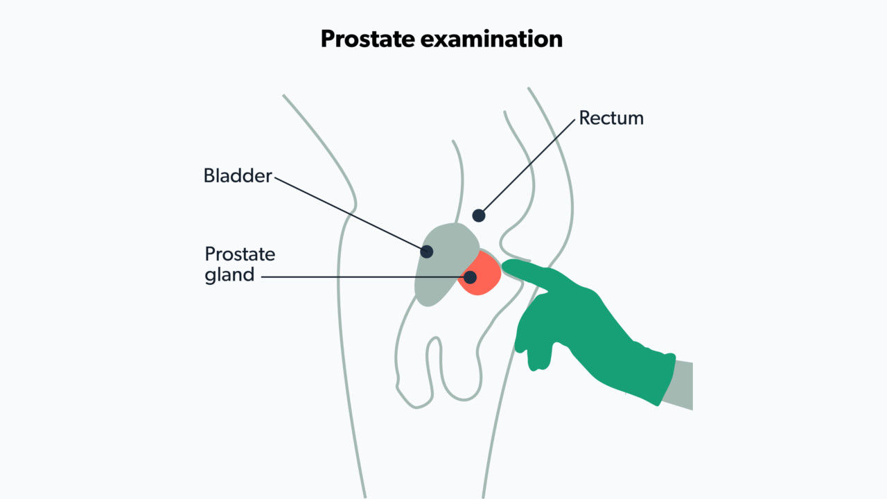 Why Do Guys Have to Cough During a Prostate Exam