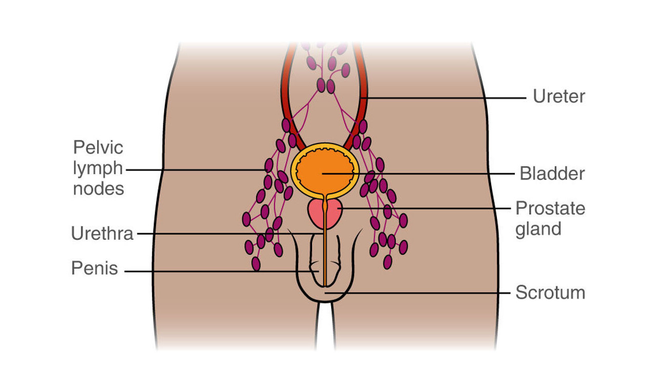 What Happens When Prostate Cancer Spreads to the Lymph Nodes