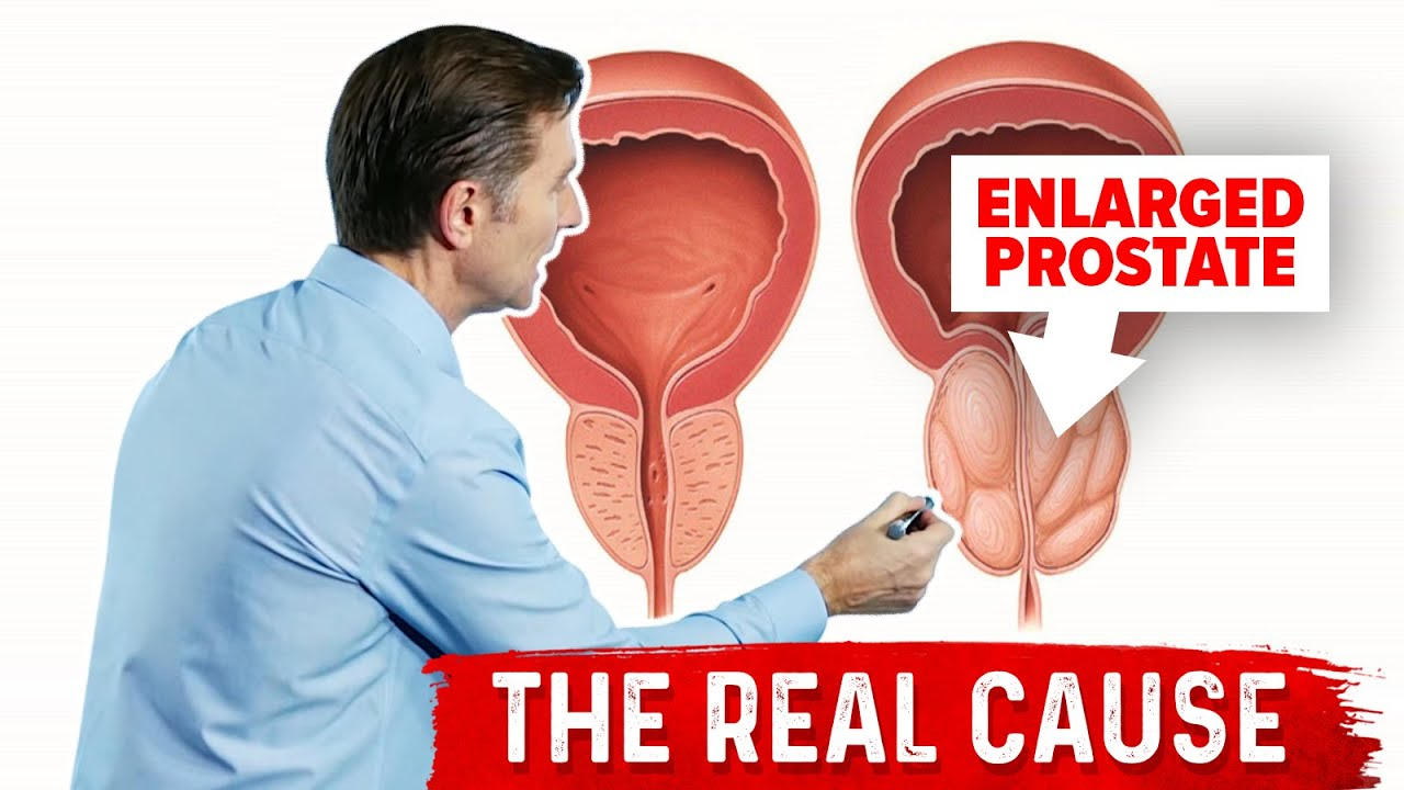 Why Does an Enlarged Prostate Cause Frequent Urination