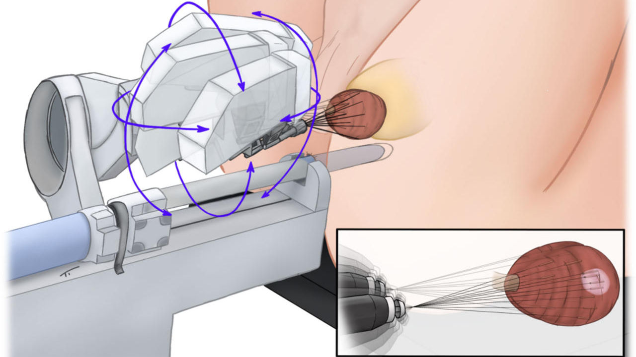 how long is a prostate biopsy